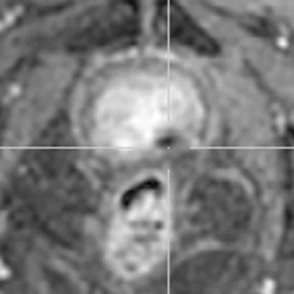 IP_PET-MRI_image44 Fig 2D.jpg