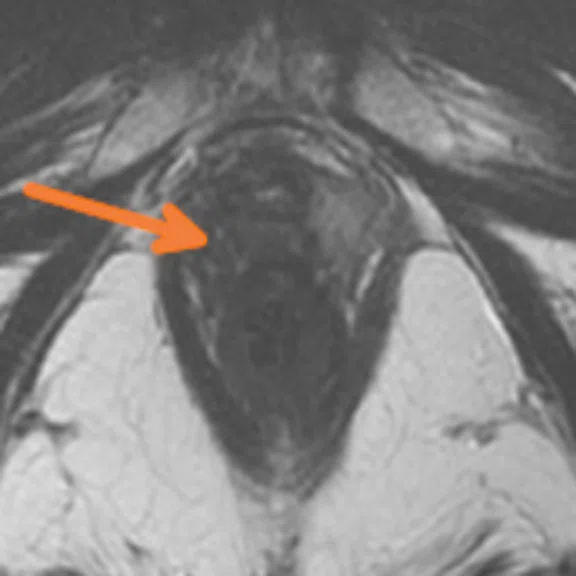 IP_PET-MRI_image60_ FIG 3A.jpg