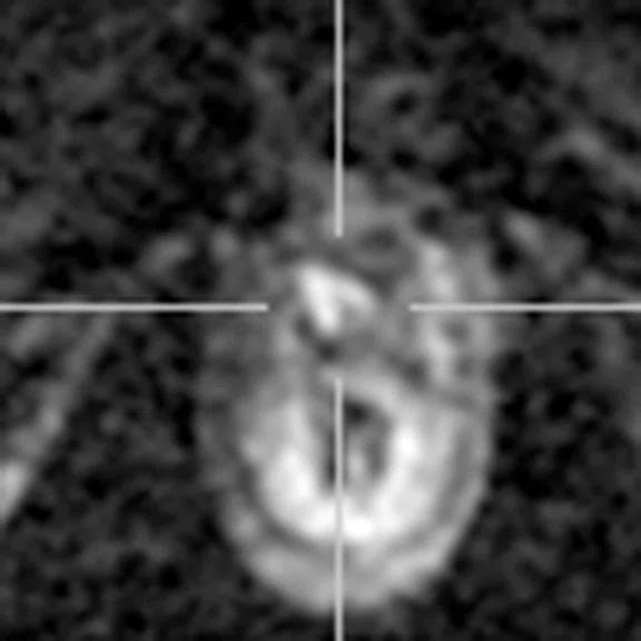 IP_PET-MRI_image61 FIG 3B.jpg