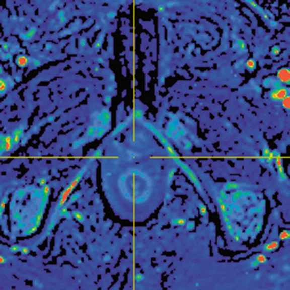 IP_PET-MRI_image64 FIG 3C.jpg