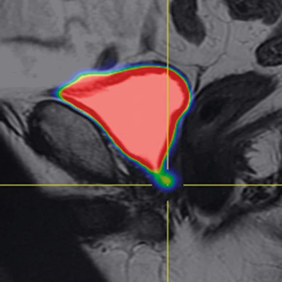 IP_PET-MRI_image63 FIG 3D.jpg