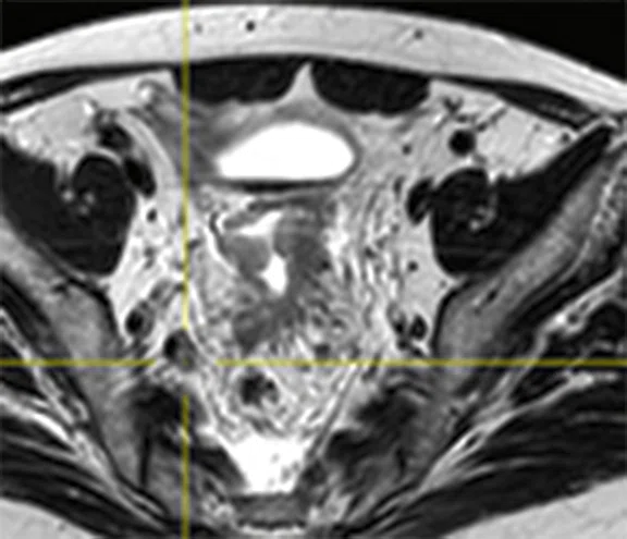 IP_PET-MRI_image72 FIG 4C.jpg