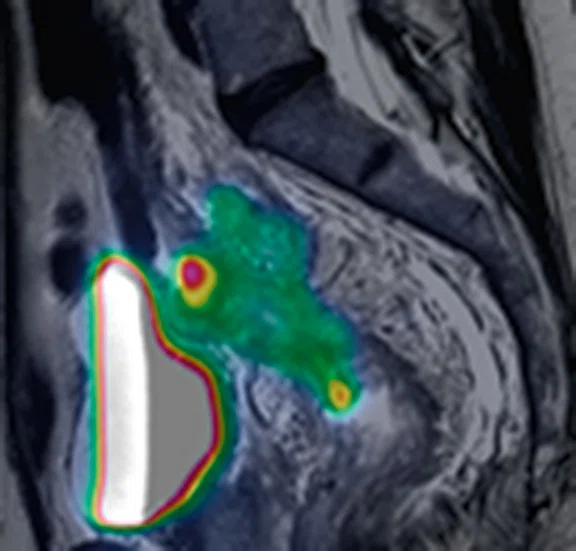 IP_PET-MRI_image71 FIG 4D.jpg