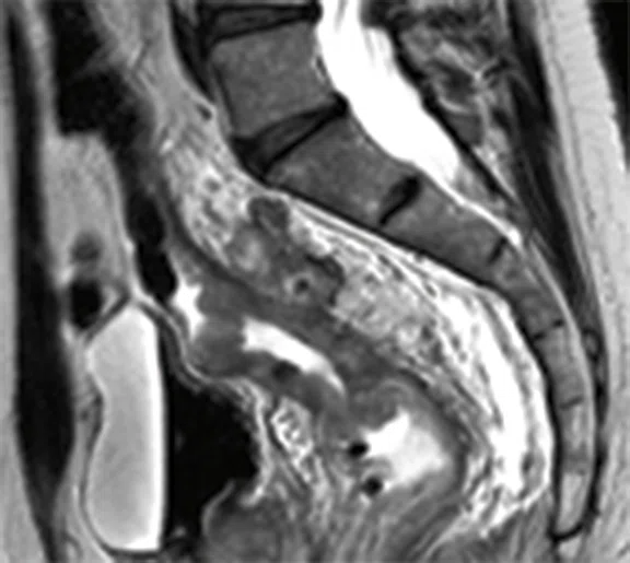 IP_PET-MRI_image71 FIG 4A.jpg