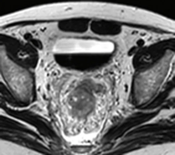 IP_PET-MRI_image71 FIG 4B.jpg