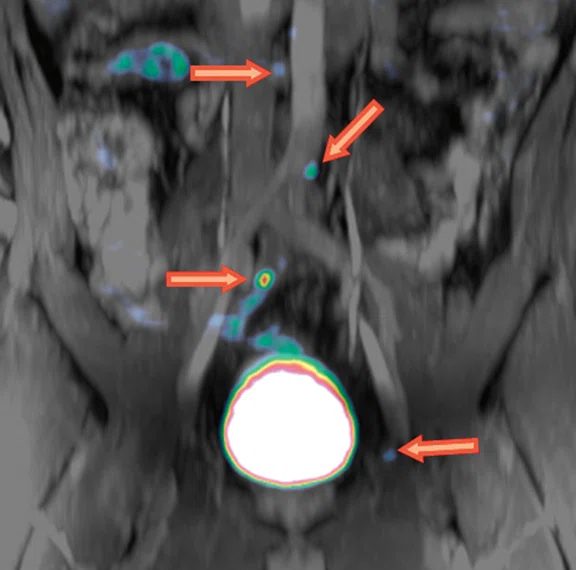 IP_PET-MRI_image76 FIG 5A.jpg