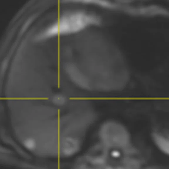 IP_PET-MRI_image78 FIG 5C.jpg