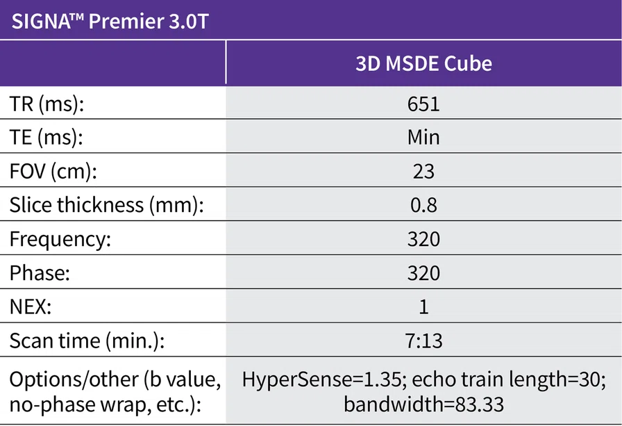 SIGNA™ Premier 3.0T Table 1.jpg