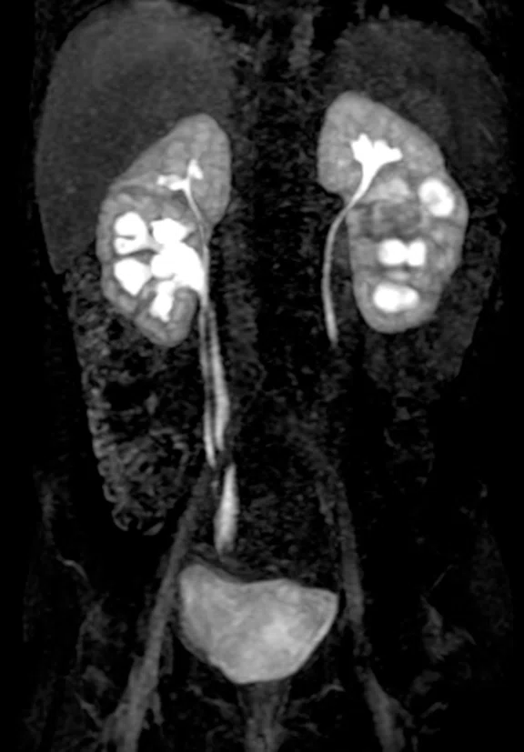 CS_Pediatric kidney TMJ_Zurich_image6_NEWFIG4 Fig 