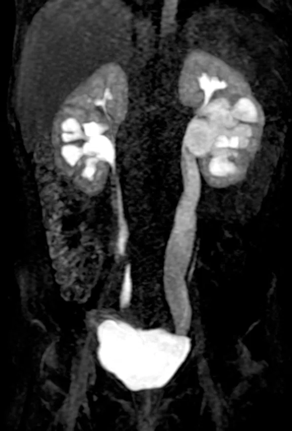 CS_Pediatric kidney TMJ_Zurich_image5_NEWFIG4 Fig 