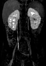 CS_Pediatric kidney TMJ_Zurich_image4_NEWFIG4 Fig 