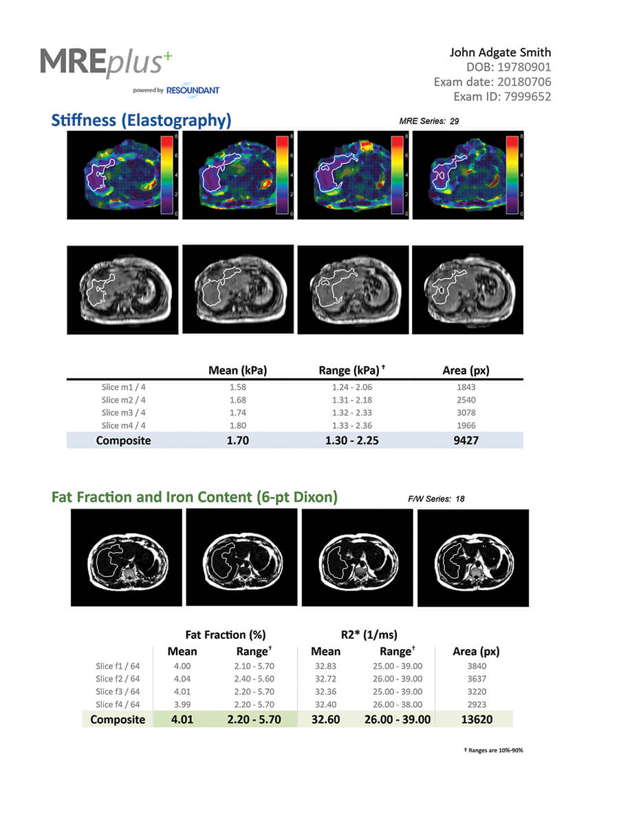 IP-Early_Liver_Health_Figure_3.jpg