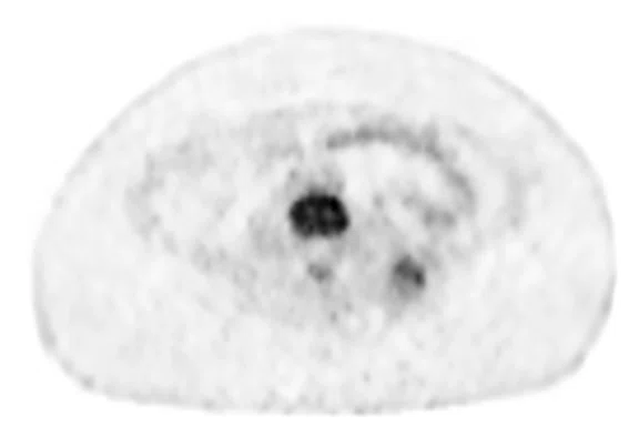 IS-PET Figure 4 Image D.jpg