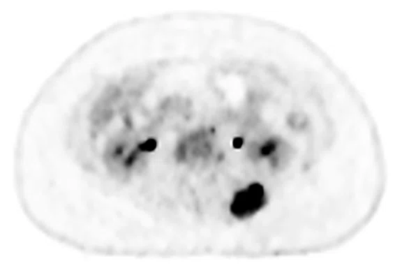 IS-PET Figure 4 Image C.jpg