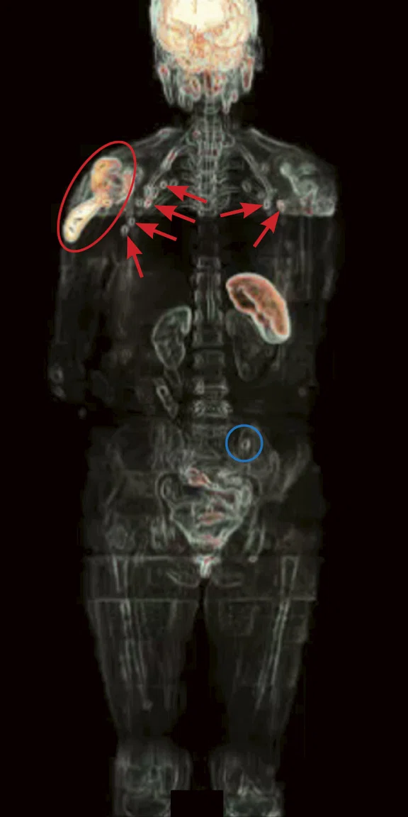 IS-Whole Body Figure 2 Image C.jpg