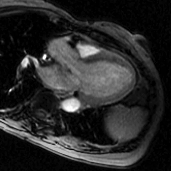 IP-Cardiac_Figure_5_Image_B.jpg