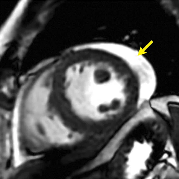 IS_Cardiac_Figure_1_Image_A.jpg