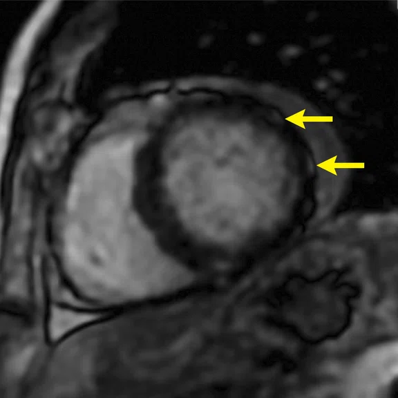 IS_Cardiac_Figure_1_Image_B.jpg