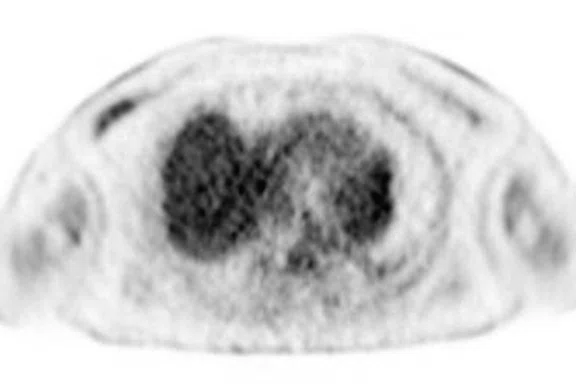 IP_PET-MRI Figure 3 Image A.jpg
