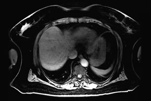 IP_PET-MRI Figure 3 Image B.jpg