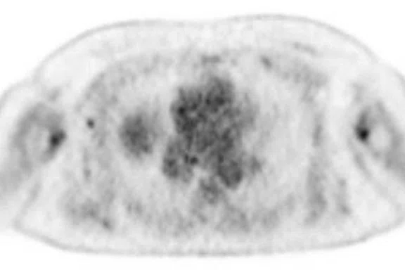 IP_PET-MRI Figure 3 Image D.jpg