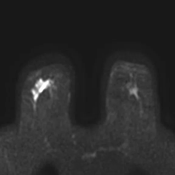 IP_PET-MRI Figure 4 Image A.jpg