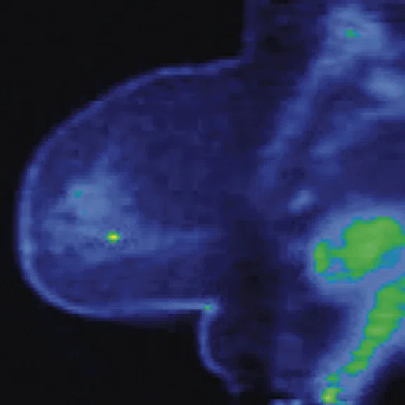 IP_PET-MRI Figure 4 Image G.jpg