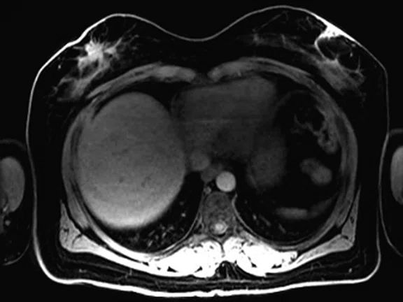 IP_PET-MRI Figure 5 Image A.jpg