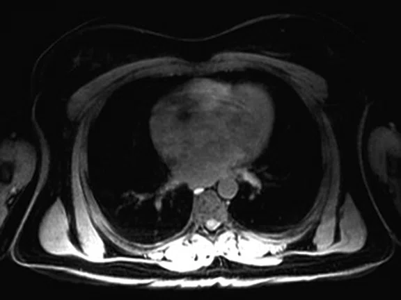 IP_PET-MRI Figure 5 Image C.jpg