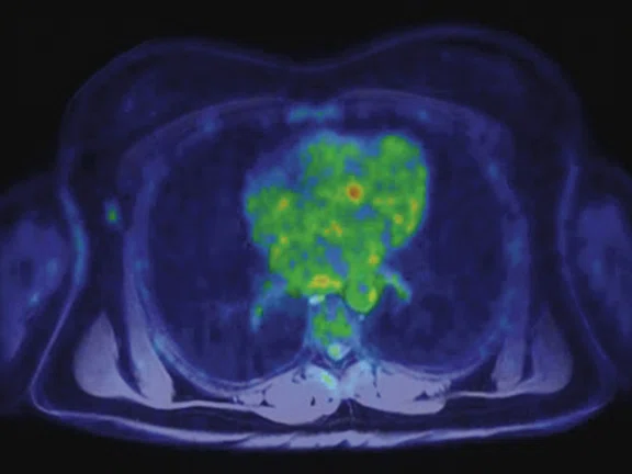 IP_PET-MRI Figure 5 Image D.jpg