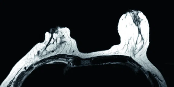 IP_PET-MRI Figure 7 Image A.jpg