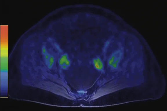 IP_PET-MRI Figure 8 Image A.jpg
