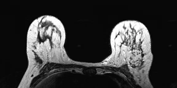 IP_PET-MRI Figure 9 Image A.jpg