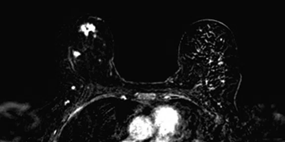 IP_PET-MRI Figure 9 Image B.jpg