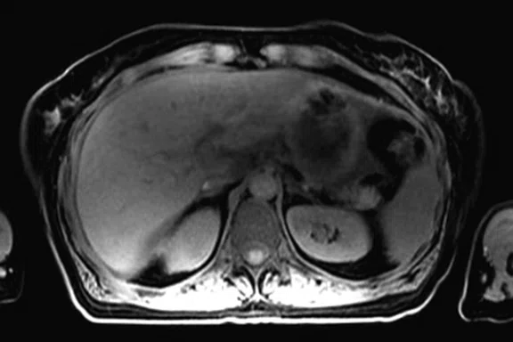 IP_PET-MRI Figure 10 Image A.jpg