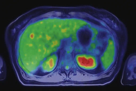 IP_PET-MRI Figure 10 Image B.jpg