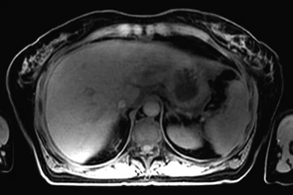 IP_PET-MRI Figure 10 Image C.jpg