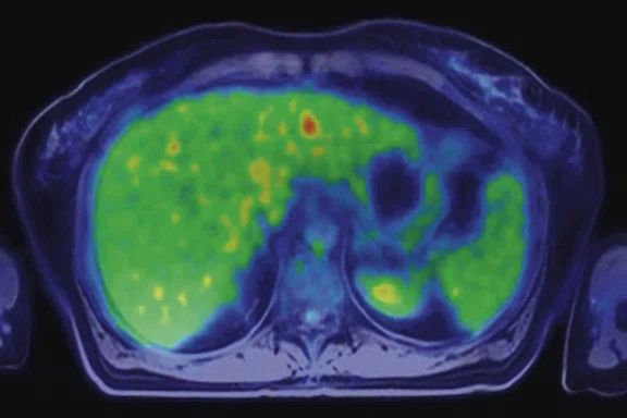 IP_PET-MRI Figure 10 Image D.jpg