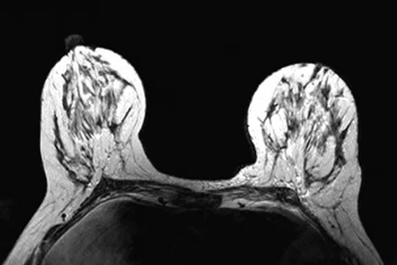 IP_PET-MRI Figure 10 Image E.jpg