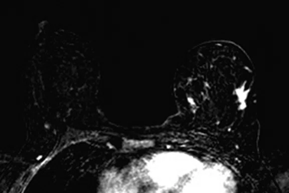 IP_PET-MRI Figure 10 Image F.jpg