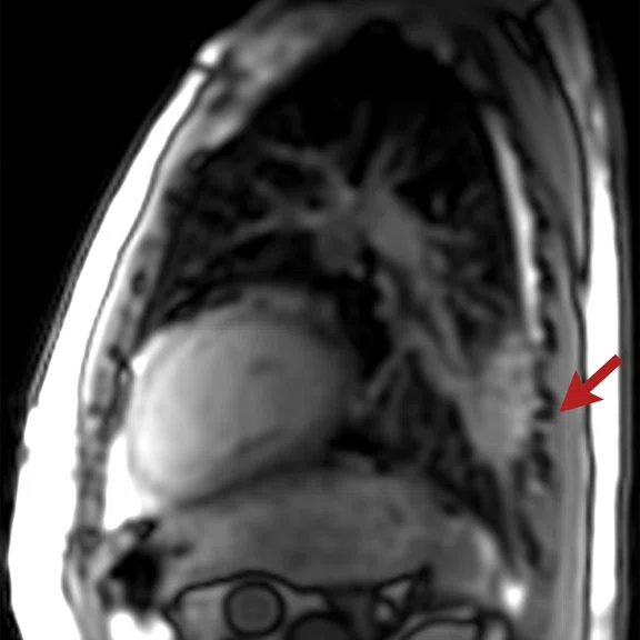 Cardiac Figure 1 Image A.jpg