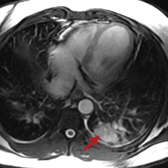 Cardiac Figure 1 Image B.jpg