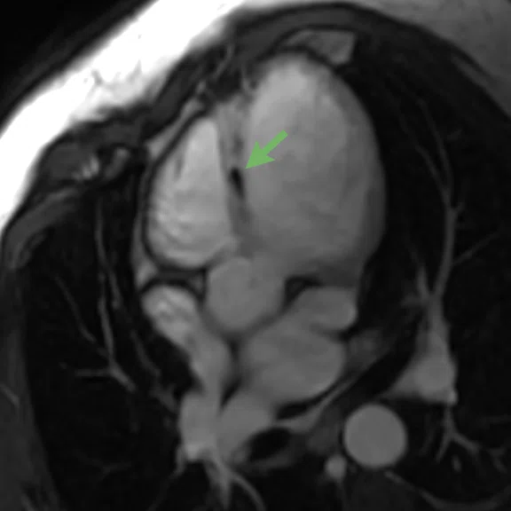 Cardiac Figure 2 Image B.jpg