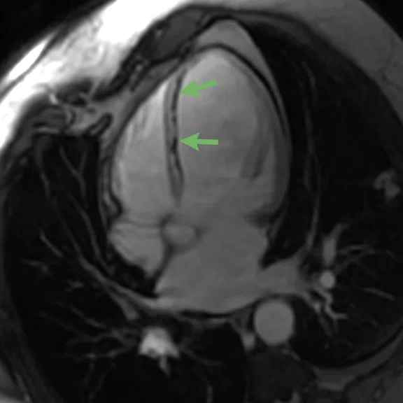 Cardiac Figure 2 Image C.jpg