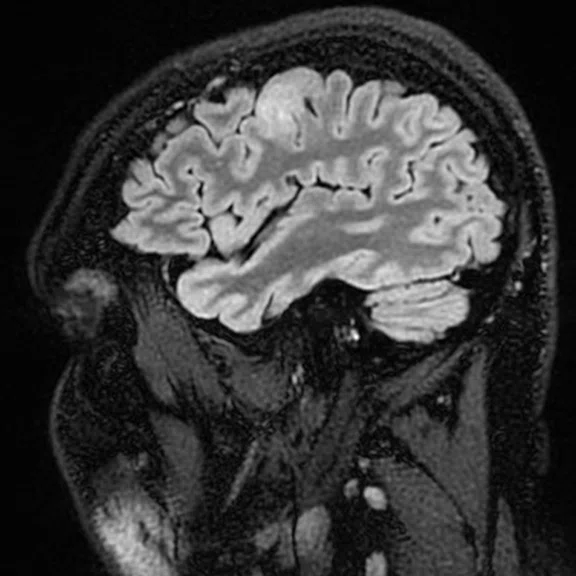 Advanced neuroimaging - Figure 1 - Image B.jpg
