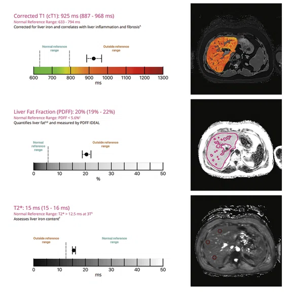 Liver imaging - Figure 2.jpg