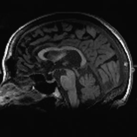 PET-MR_Neuroimaging - Figure 1 - Image I.jpg